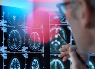 OMS : Alerte mondiale sur la hausse des troubles neurologiques