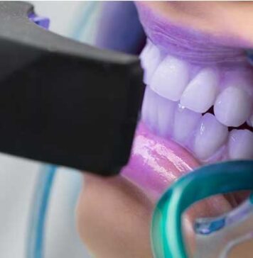 Tunisie : alerte contre les services informels de blanchiment dentaire