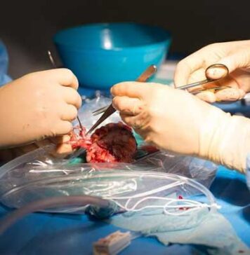 Greffe de rein : la liste d’attente dépasse 1500 patients en Tunisie