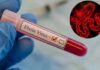 Tunisie : aucune menace directe liée au virus Ebola, selon le ministère de la Santé