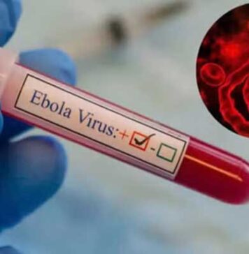 Tunisie : aucune menace directe liée au virus Ebola, selon le ministère de la Santé