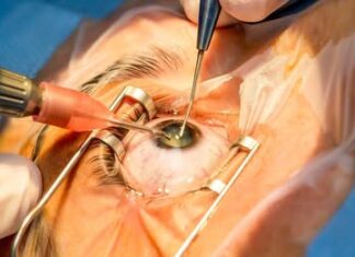 Kasserine : des opérations gratuites de la cataracte pour 50 patients annoncées