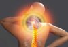 Tunisie: La douleur chronique diffuse est souvent le symptôme principal de la fibromyalgie