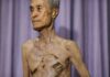 Hiroshima et Nagasaki : Tsutomu Yamaguchi, le seul survivant reconnu des deux bombardements !
