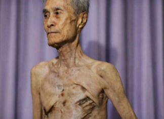 Hiroshima et Nagasaki : Tsutomu Yamaguchi, le seul survivant reconnu des deux bombardements !