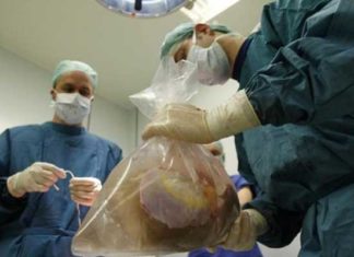 Don d’organes : sept familles sur dix refusent le prélèvement