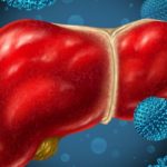 Hépatite virale : un danger silencieux, mais guérissable avec un traitement adapté