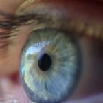 Kératocône et risques oculaires : pourquoi éviter de se frotter les yeux