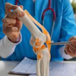 Santé articulaire : les femmes plus exposées à l’usure du cartilage du genou, selon une étude tunisienne