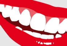 Sourire éclatant : les recommandations d’un spécialiste avant et après un blanchiment dentaire