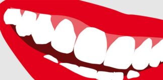 Sourire éclatant : les recommandations d’un spécialiste avant et après un blanchiment dentaire