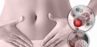 Papillomavirus humain : 80 à 90 % des personnes infectées, le vaccin reste la clé de prévention