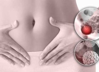 Papillomavirus humain : 80 à 90 % des personnes infectées, le vaccin reste la clé de prévention