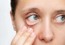 Anémie infantile : l’OMS souligne les dangers pour le développement cognitif et physique