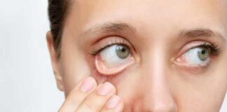 Anémie infantile : l’OMS souligne les dangers pour le développement cognitif et physique