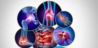 Tunisie : la fibromyalgie, un syndrome complexe marqué par douleurs, fatigue et troubles du sommeil