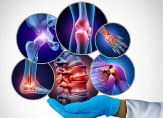 Tunisie : la fibromyalgie, un syndrome complexe marqué par douleurs, fatigue et troubles du sommeil