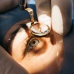 Santé oculaire : la Tunisie lance une campagne nationale pour opérer gratuitement 1000 patients atteints de cataracte