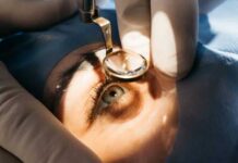 Santé oculaire : la Tunisie lance une campagne nationale pour opérer gratuitement 1000 patients atteints de cataracte