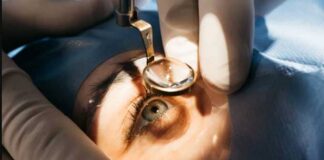 Santé oculaire : la Tunisie lance une campagne nationale pour opérer gratuitement 1000 patients atteints de cataracte