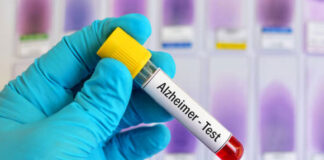 Mémoire et Alzheimer : que révèle un nouveau biomarqueur sanguin ?