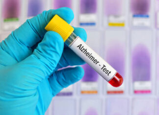 Mémoire et Alzheimer : que révèle un nouveau biomarqueur sanguin ?